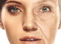 Реакція шкіри на ультрафіолет, дерматогеліоз, фотостаріння – причини та фактори