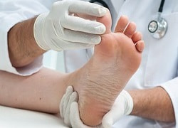 Лечение гиперкератоза в Кривом Роге, профилактика кератодермии