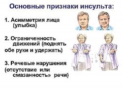 Обратите внимание на первые признаки инсульта и нарушения кровообращения