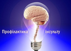 Профілактика інсульту, тести, перші ознаки інфаркту головного мозку