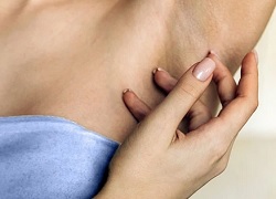 Как вывести папилломы под мышками – удаление радиоволной в дерматохирургии
