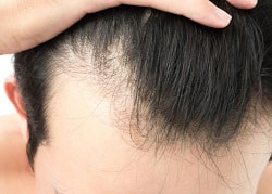 Акция! Скидка 40% на восстановление волос в Кривом Роге, Regenera Activa